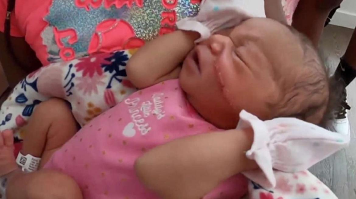 A una beba le cortaron la cara durante una cesárea y debió recibir 13 puntos de sutura: “Nunca vimos algo como esto”